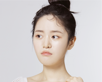 색소 침착이 고민인 여성 이미지